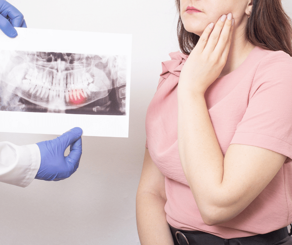 Wisdom Teeth Removal In London, Ontario