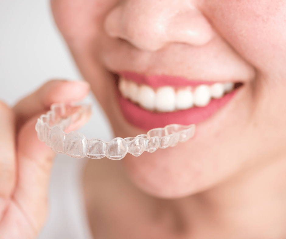 Invisalign in London
