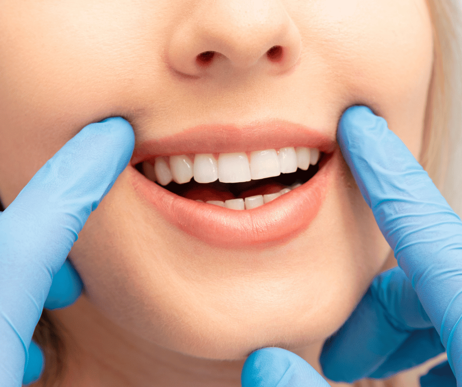 Tooth Filling